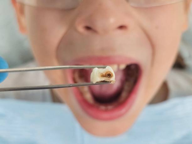 Best Emergency Orthodontic Repairs in Grabill, IN